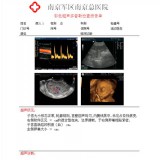 国产胶片 医用胶片生产厂家 安徽胶片厂家 菲力姆供